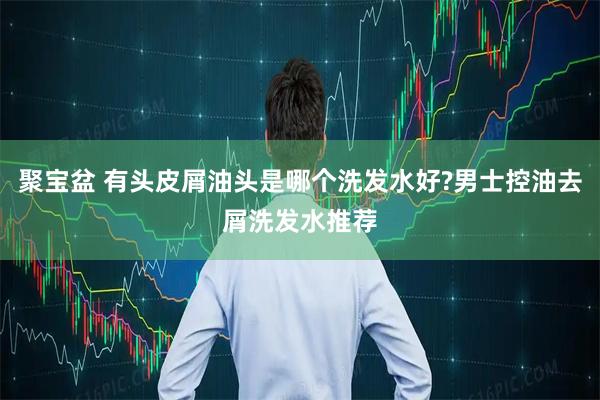 聚宝盆 有头皮屑油头是哪个洗发水好?男士控油去屑洗发水推荐